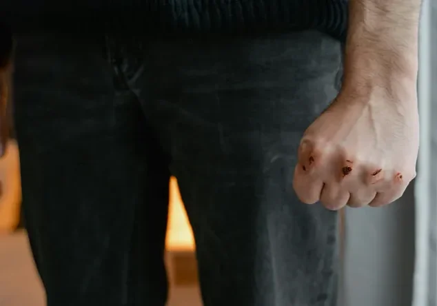 Clenched fist with bloody knuckles